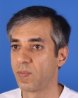 After Hair Transplant&nbsp;2 Sessions (Areas)